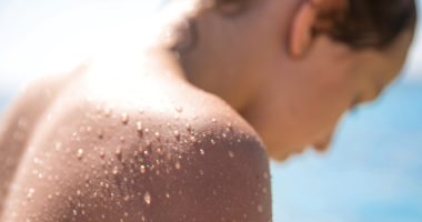 Cómo afecta la piscina a tu piel